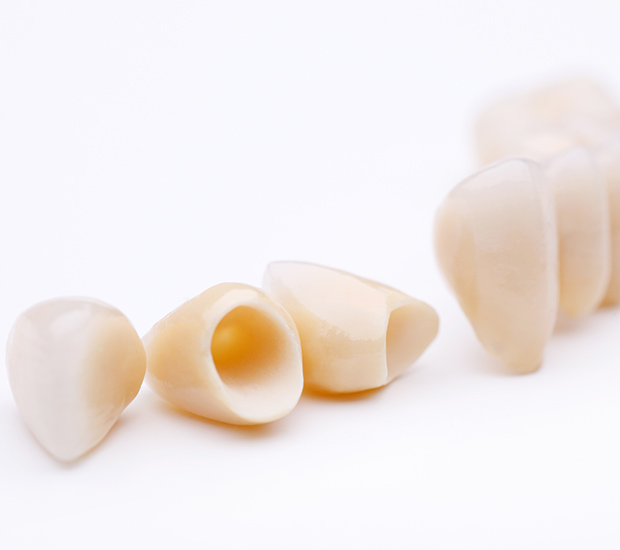 Springfield Dental Crowns and Dental Bridges