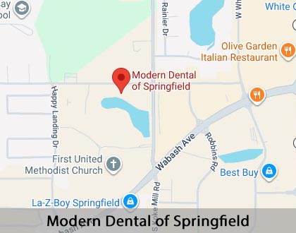 Map image for I Think My Gums Are Receding in Springfield, IL