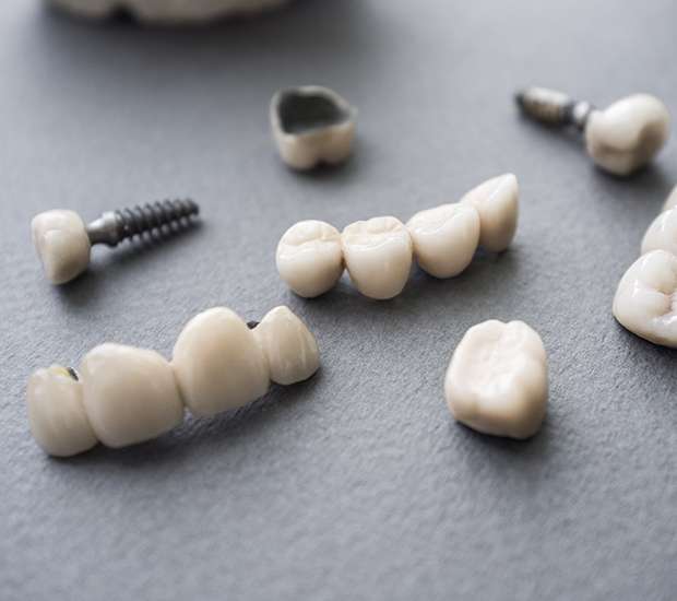 Springfield The Difference Between Dental Implants and Mini Dental Implants