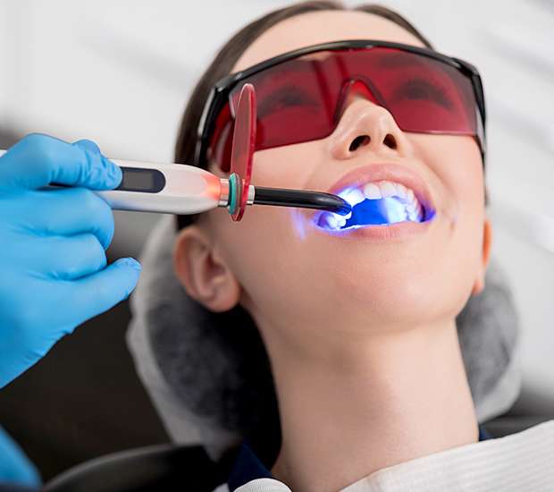 Springfield Professional Teeth Whitening